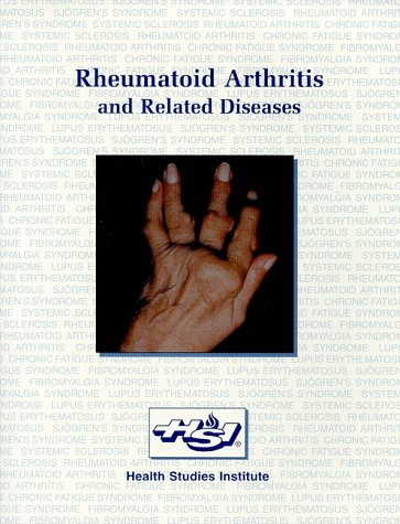 Stock image for Rheumatoid Arthritis and Related Diseases: for sale by ThriftBooks-Atlanta