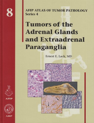 Beispielbild fr Tumors of the Adrenal Glands and Extraadrenal Paraganglia - Volume 8 (Afip Atlas of Tumor Pathology Series 4) zum Verkauf von Wonder Book