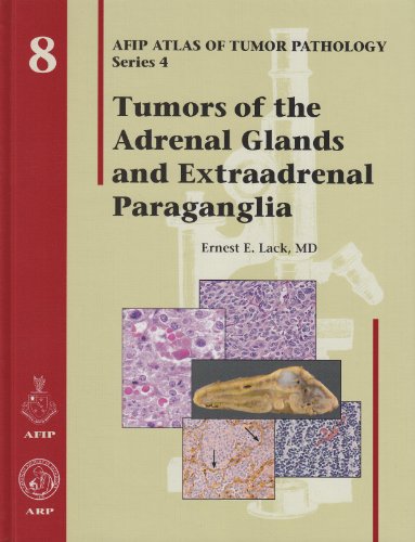 Stock image for Tumors of the Adrenal Glands and Extraadrenal Paraganglia - Volume 8 (Afip Atlas of Tumor Pathology Series 4) for sale by Wonder Book
