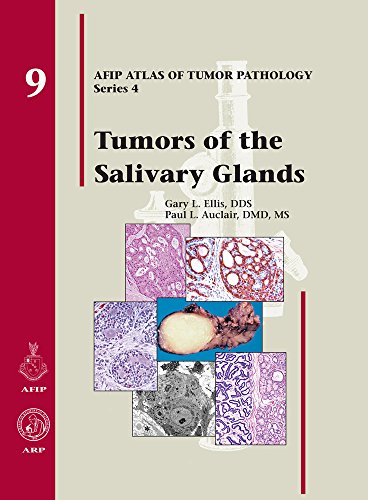 9781881041023: Tumors of the Salivary Glands: 9 (AFIP Atlas of Tumor Pathology, Series 4,)