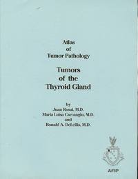 Stock image for Tumors of the Thyroid Gland for sale by ThriftBooks-Atlanta