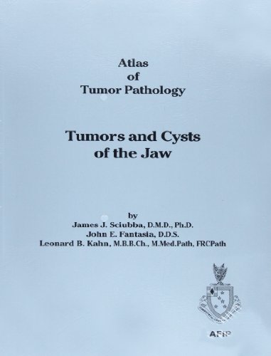 Beispielbild fr Tumors and Cysts of the Jaws (Atlas of Tumor Pathology) zum Verkauf von Anybook.com