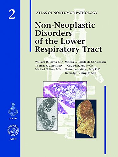 9781881041795: Non-Neoplastic Disorders of the Lower Respiratory Tract: 02 (Atlas of Non-Tumor Pathology, Series 1,)
