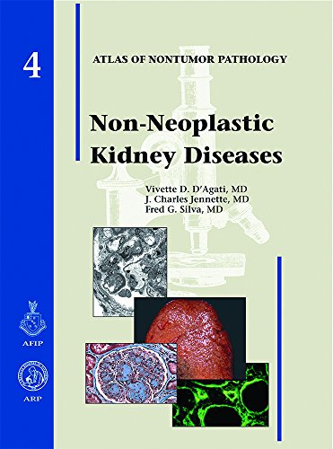 Stock image for Non-neoplastic Kidney Diseases (Atlas of Nontumor Pathology) for sale by Wonder Book