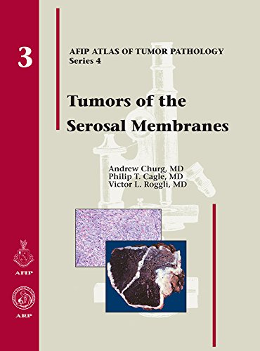 Imagen de archivo de Tumors of the Serosal Membranes a la venta por Better World Books