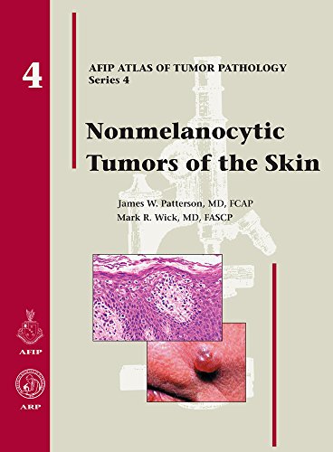 Beispielbild fr Nonmelanocytic Tumors of the Skin zum Verkauf von Better World Books