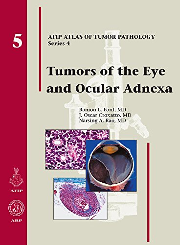 Beispielbild fr Tumors of the Eye and Ocular Adnexa (Afip Atlas of Tumor Pathology) zum Verkauf von Wonder Book