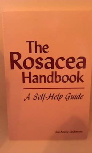 Beispielbild fr The Rosacea Handbook: A Self-Help Guide zum Verkauf von SecondSale