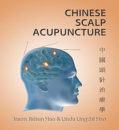 Beispielbild fr Chinese Scalp Acupuncture zum Verkauf von GF Books, Inc.