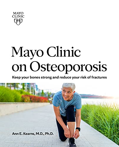 9781893005242: Mayo Clinic on Osteoporosis: Keep your bones strong and reduce your risk of fractures