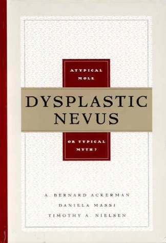 Dysplastic Nevus: A Typical Mole or Typical Myth (9781893357013) by Ackerman, A. Bernard, M.D.; Massi, Daniela, M.D.; Nielsen, Timothy A., M.D.; Ackerman, A. Bernard; Massi, Daniela; Nielsen, Timothy A.