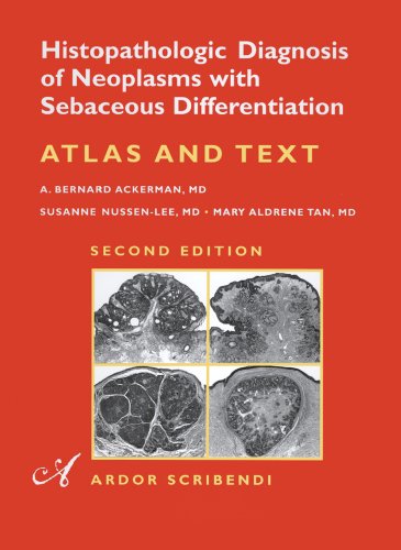 Histopathologic Diagnosis of Neoplasms with Sebaceous Differentiation. Atlas & Text (9781893357372) by A. Bernard Ackerman; Susane Nussen-Lee; Mary A.L. Tan