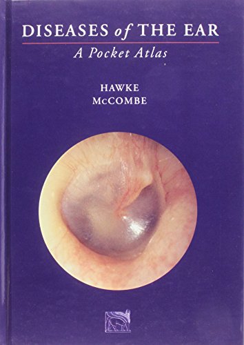 Diseases of the Ear: A Pocket Atlas