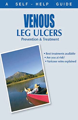 Stock image for The Doctor's Guide to: Venous Leg Ulcers: Prevention and Treatment (Dr. Guide Books) for sale by GF Books, Inc.