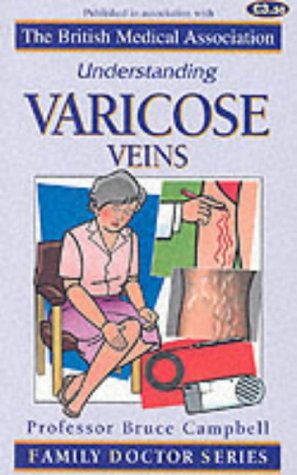 Beispielbild fr Understanding Varicose Veins (Family Doctor Series) zum Verkauf von AwesomeBooks