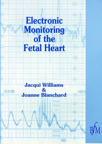 9781898507116: Electronic Monitoring of Fetal Heart (Midwifery Practice Guide S.)
