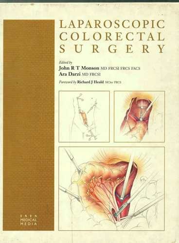 Stock image for Laparoscopic Colorectal Surgery for sale by Better World Books Ltd