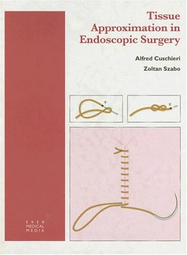 Beispielbild fr Tissue Approximation in Endoscopic Surgery: Suturing & Knotting zum Verkauf von HPB-Red