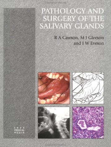 Pathology and Surgery of the Salivary Glands (9781899066612) by Cawson, R A; Eveson, J W; Gleeson, M J; Cawson, R.