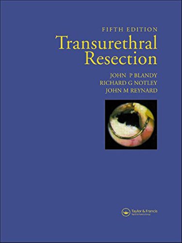 Imagen de archivo de Transurethral Resection a la venta por Better World Books Ltd