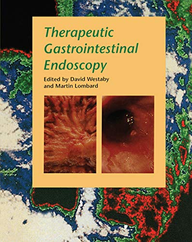 Beispielbild fr Therapeutic Gastrointestinal Endoscopy zum Verkauf von P.C. Schmidt, Bookseller