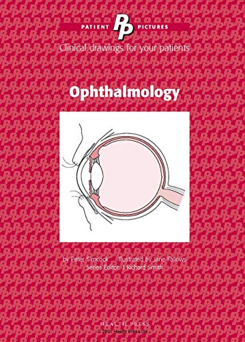 Stock image for Ophthalmology (Patient Pictures): Clinical drawings for your patients Illustrated by Jane Fallows for sale by WorldofBooks