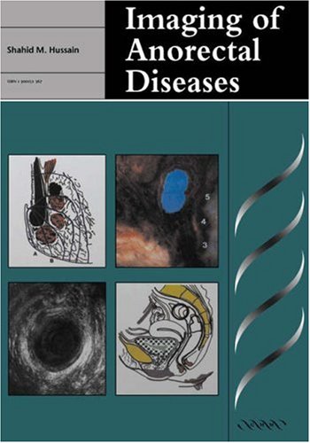 Beispielbild fr Imaging of Anorectal Diseases zum Verkauf von Books Puddle