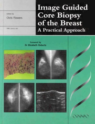 Stock image for Image Guided Core Biopsy of the Breast for sale by Books Puddle