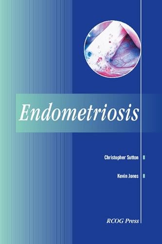 Imagen de archivo de Endometriosis a la venta por Better World Books: West