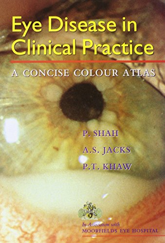 Beispielbild fr Eye Disease in Clinical Practice: A Concise Colour Atlas zum Verkauf von Goldstone Books