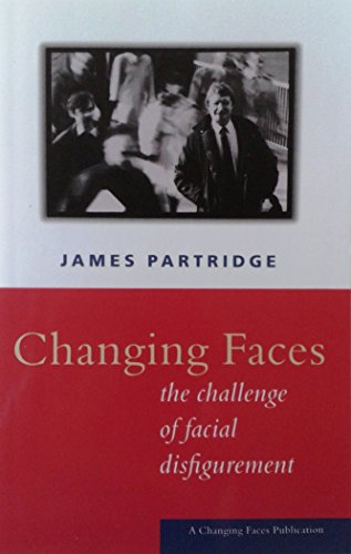 Beispielbild fr Changing Faces: The Challenge of Facial Disfigurement zum Verkauf von WorldofBooks