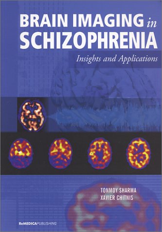 Imagen de archivo de Brain Imaging in Schizophrenia a la venta por Books Puddle