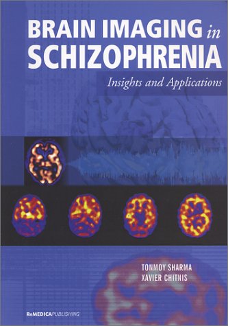 Stock image for Brain Imaging in Schizophrenia for sale by Books Puddle
