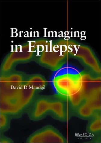 Imagen de archivo de Brain Imaging in Epilepsy a la venta por Books Puddle