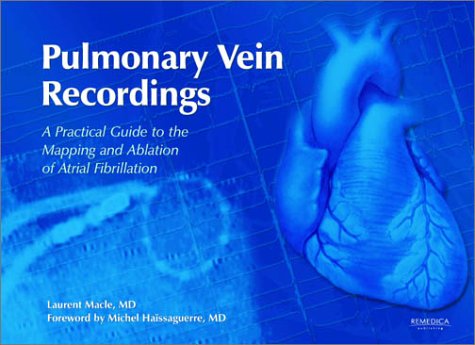 Stock image for Pulmonary Vein Recordings: A Practical Guide to the Mapping & Ablation of Atrial Fibrillation for sale by GF Books, Inc.