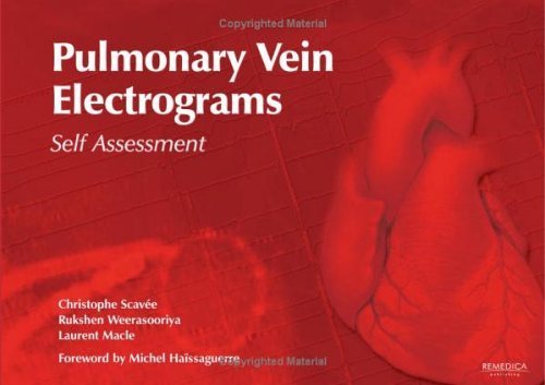 Stock image for Pulmonary Vein Electrograms: Self Assessment for sale by The Book Spot