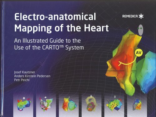Stock image for Electro-anatomical Mapping of the Heart: An Illustrated Guide to the Use of the Carto System for sale by Revaluation Books