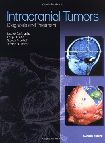 Stock image for Primary Tumours of the Central Nervous System for sale by Better World Books