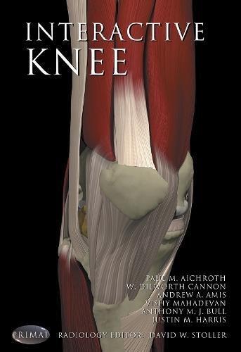 Beispielbild fr Interactive Knee 1.1 zum Verkauf von HPB-Red