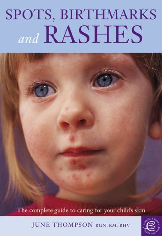 9781903258514: Spots, Birthmarks and Rashes: The Complete Guide to Caring for Your Child's Skin