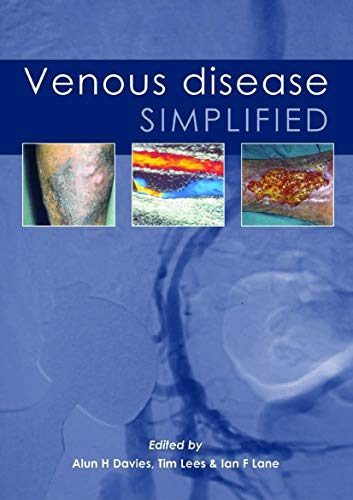 Imagen de archivo de Venous Disease Simplified a la venta por AwesomeBooks