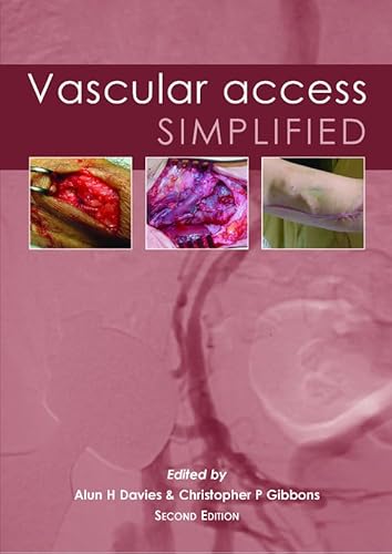 Imagen de archivo de Vascular Access Simplified a la venta por SecondSale