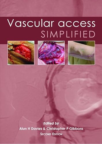 Stock image for Vascular Access Simplified for sale by SecondSale