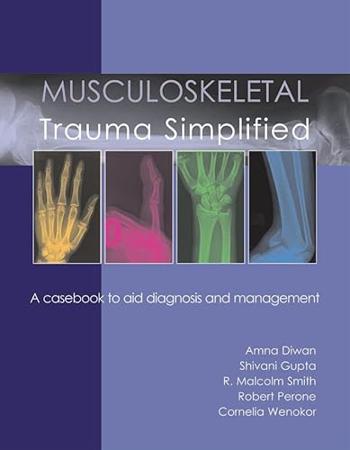 9781903378632: Musculoskeletal Trauma Simplified
