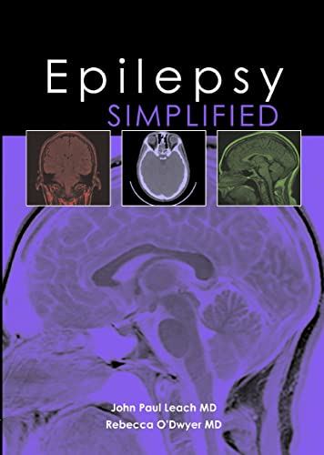 9781903378731: Epilepsy Simplified (Simplified (TFM Publishing))