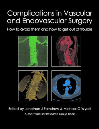 9781903378809: Complications in Vascular & Endovascular Surgery: How to Avoid Them & How to Get Out of Trouble