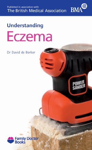 Imagen de archivo de Eczema (Understanding) (Family Doctor Books) a la venta por WorldofBooks