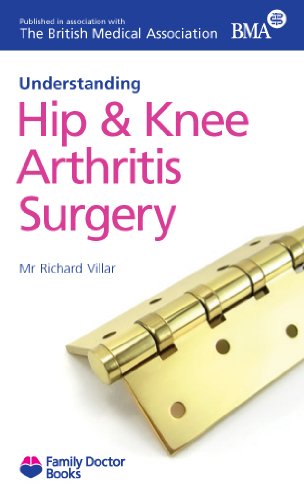 Imagen de archivo de Hip and Knee Arthritis Surgery (Understanding) (Family Doctor Books) a la venta por WorldofBooks