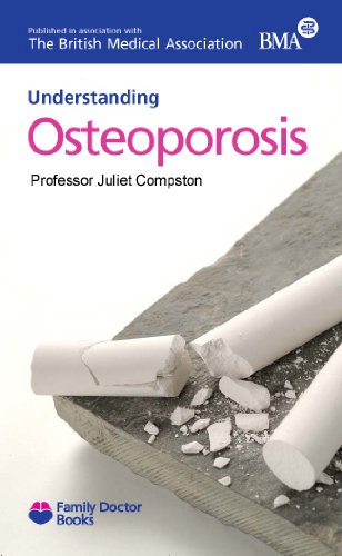 Stock image for Osteoporosis (Understanding) (Family Doctor Books) for sale by WorldofBooks