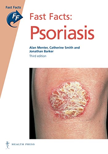 Beispielbild fr Fast Facts: Psoriais, 3rd edition (Fast Facts series) zum Verkauf von WorldofBooks